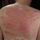 The marks of almost 200 lashes given by Dominatrix Mistress Troy, New York City